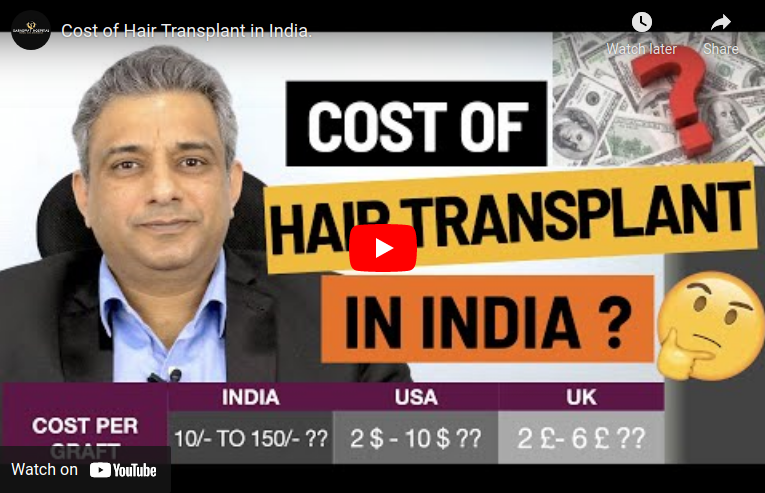 What is the Hair Transplant Cost in India ? - Saraswat Hospital Agra