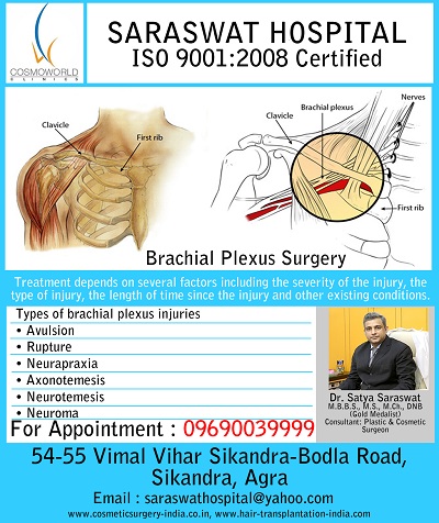 Brachial Plexus Surgery