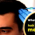 What is the best hair transplant method