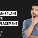 Hair Transplant vs Hair Replacement