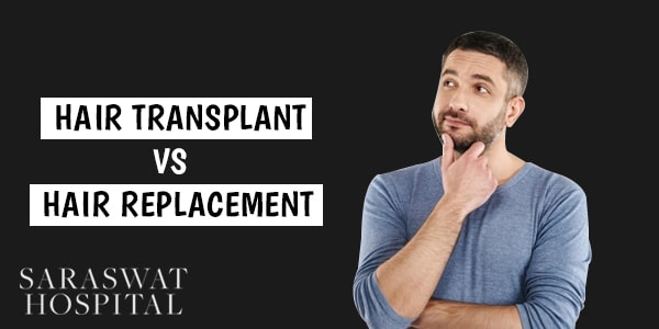 Hair Transplant vs Hair Replacement