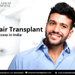 Hair-Transplant-in-India