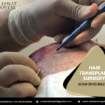 hair-transplant-surgery
