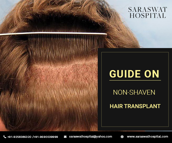 An All-Inclusive Guide On Non-Shaven Hair Transplant Surgery