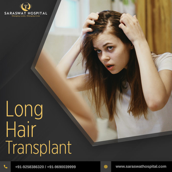 Know About Long Hair Transplant