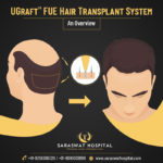 UGraft™ Hair Transplant System