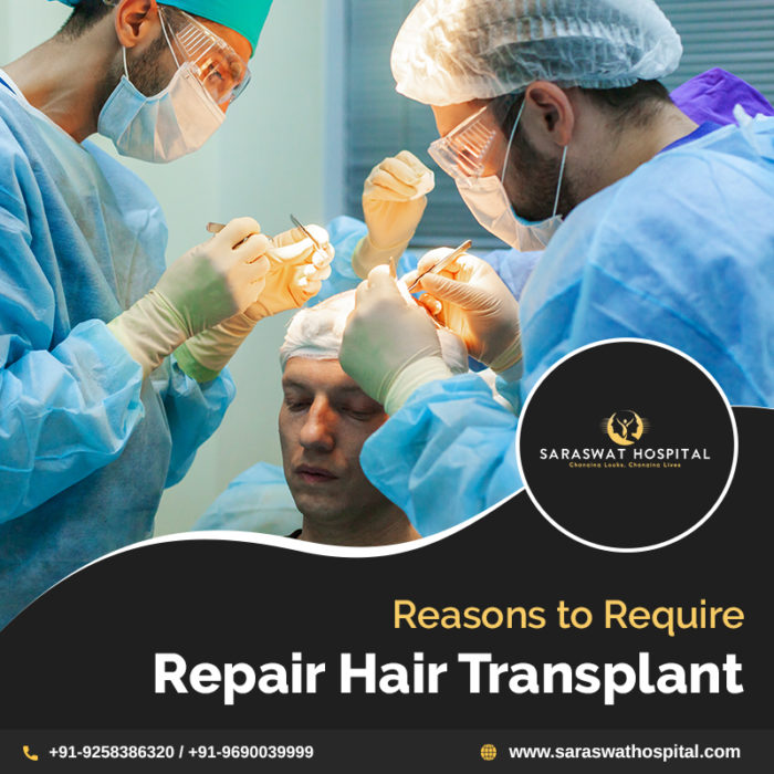 Why Does One Require Repair Hair Transplant