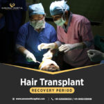 Hair Transplant Recovery Period