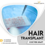Hair Transplant Cost Per Graft India