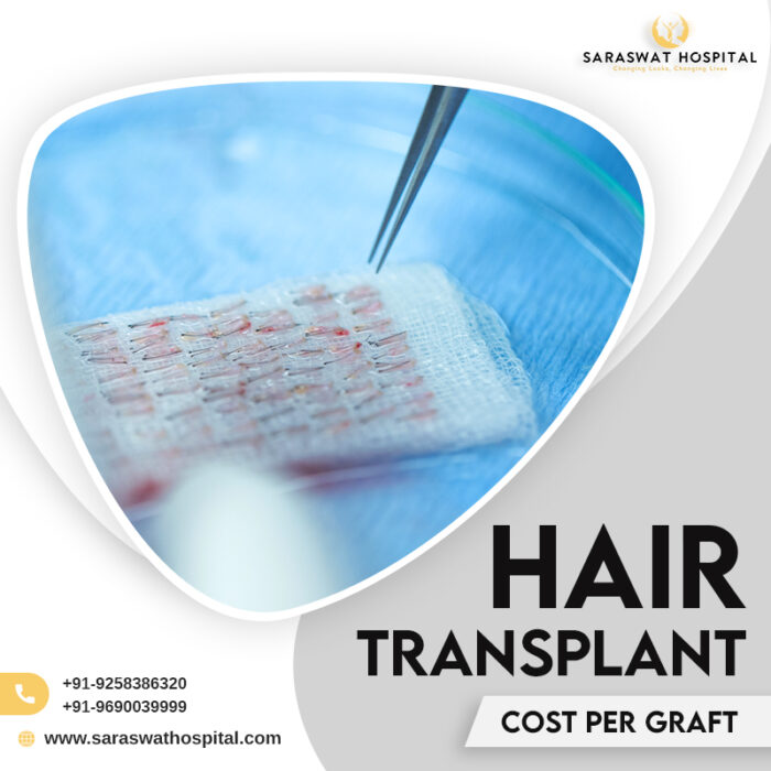 How Much is the Hair Transplant Cost Per Graft in India?