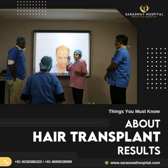 Hair Transplant Results in India