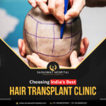 How to Choose the Best Hair Transplant Clinic in India