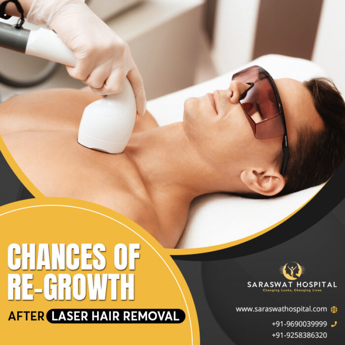 Is There a Chance of Re-growth after Laser Hair Removal Agra?