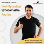 Benefits of a Good Post-Op Gynecomastia Routine