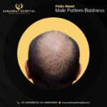 Male Pattern Baldness FAQ's