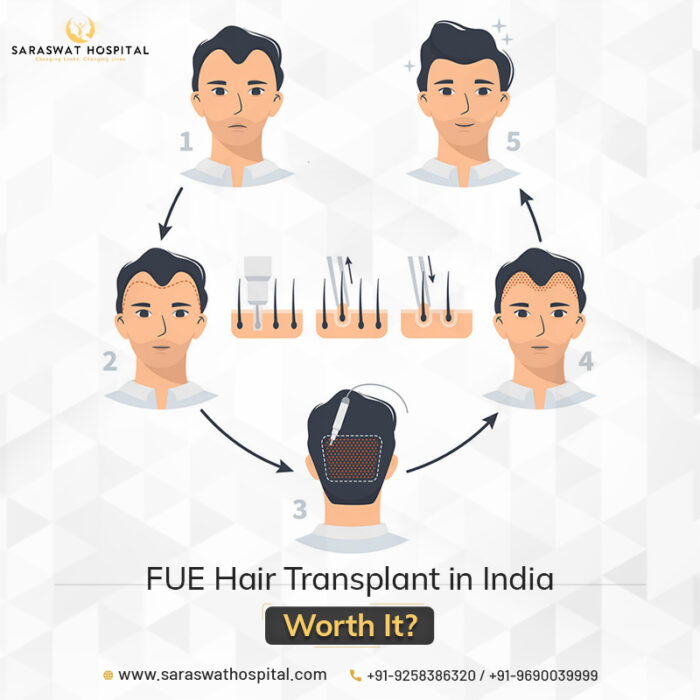 Is Undergoing FUE Hair Transplant in India Worth It