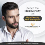 Reach the Ideal Density with High Density Hair Transplant
