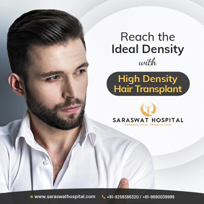 How to Achieve the Ideal Density through High Density Hair Transplant?