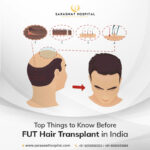Top Things to Know Before FUT Hair Transplant in India