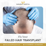 Fix your Failed Hair Transplant