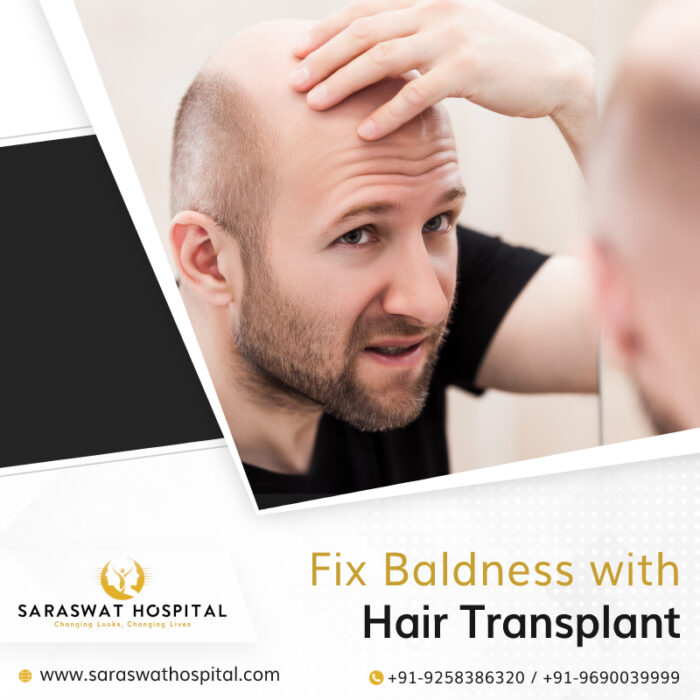 How a Hair Transplant Surgery Fixes Baldness