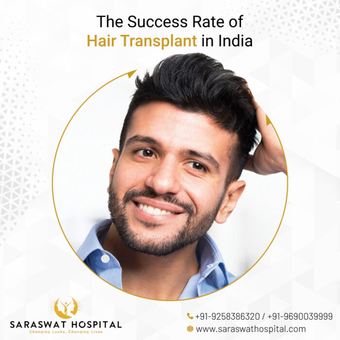 What Is the Success Rate of Hair Transplant? | Saraswat Hospita
