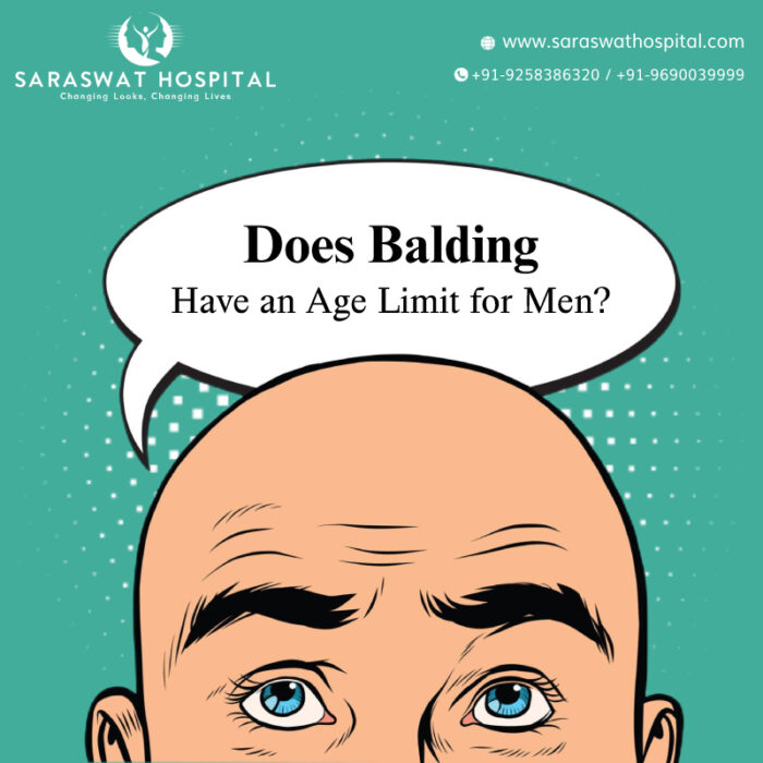 Does Balding Ever Stop in Men