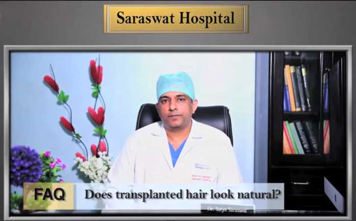 does hair transplant looks natural