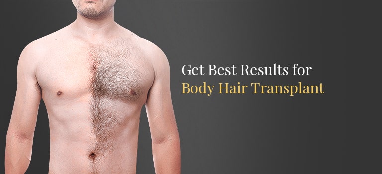 Body Hair Transplant in India