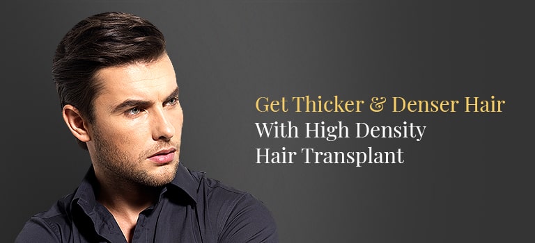 High Density Hair Transplant in India