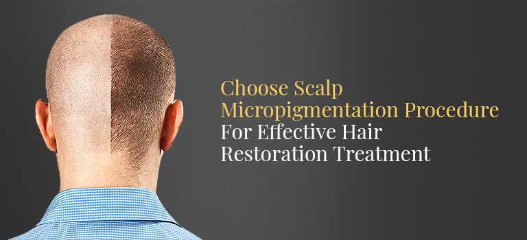 Scalp Micropigmentation in India