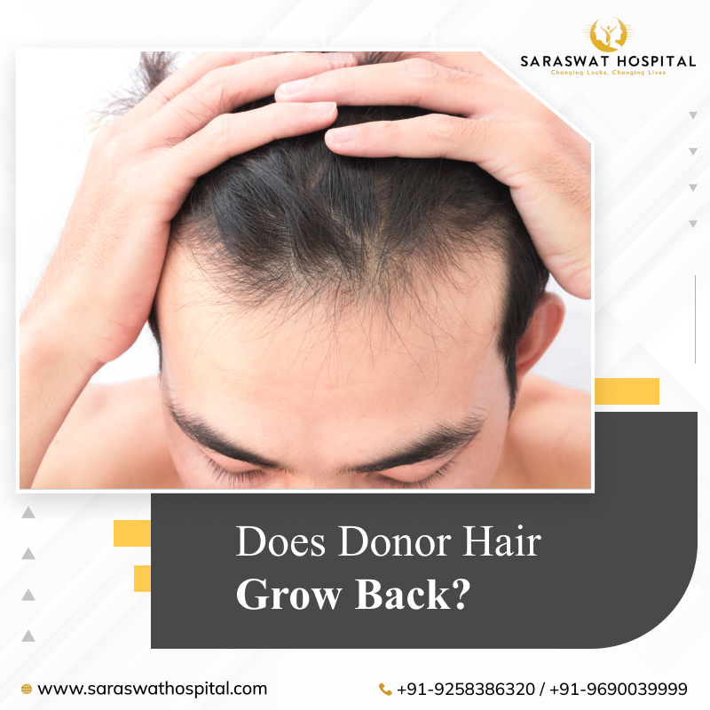 Does Donor Hair Grow Back after FUE Hair Transplant in India?