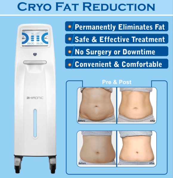 MICOOL-A™ Cryo Fat Reduction