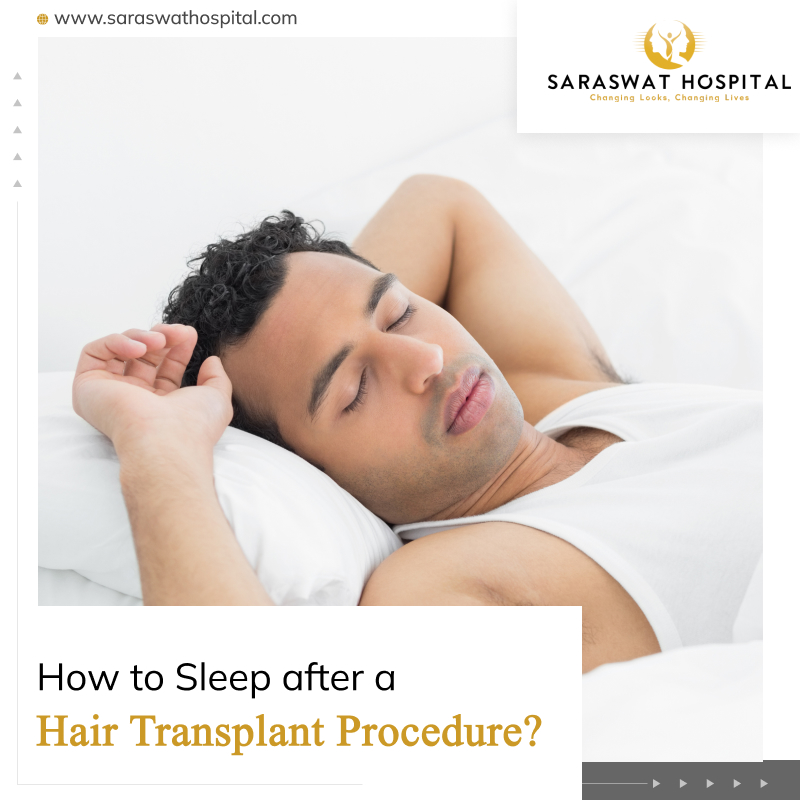 How to sleep after a hair transplant procedure