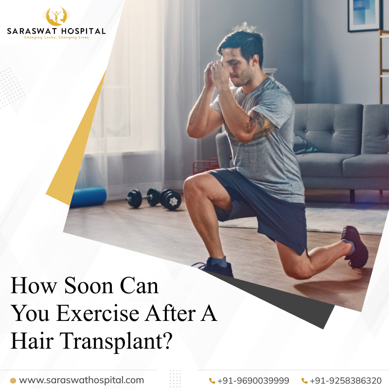 exercise after hair transplant