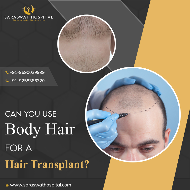 Can you use Body Hair for a Hair Transplant