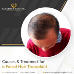 Causes and Treatment of a failed hair transplant