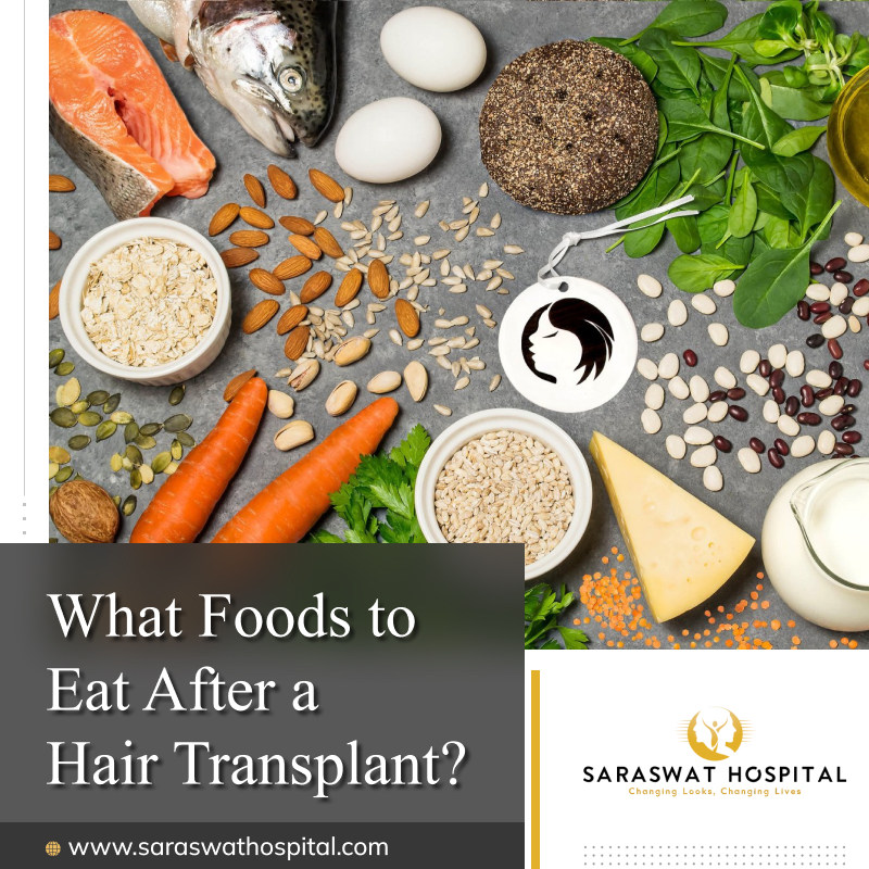 Best Diet after a Hair Transplant