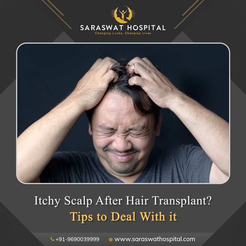 How to Deal with an Itchy Scalp after a Hair Transplant