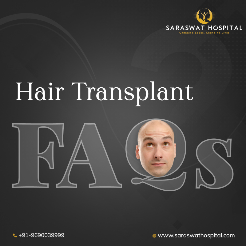What are the Commonly Asked Questions for a Hair Transplant?