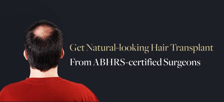 Hair Transplant Clinic in Agra
