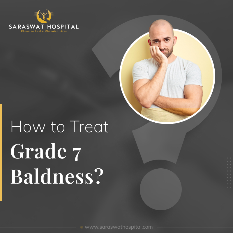 Can Grade 7 Baldness be Treated with a Hair Transplant?