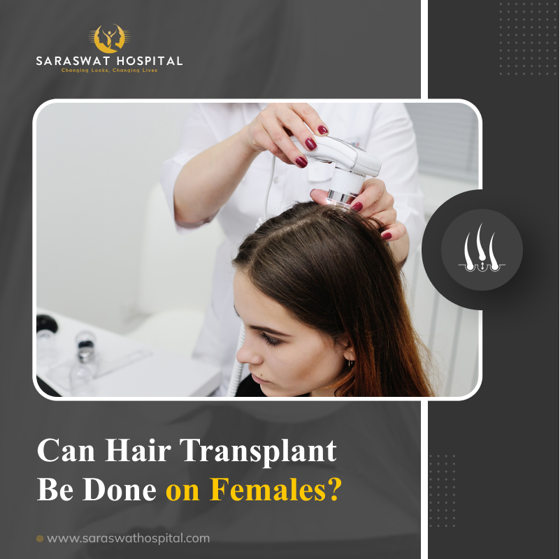 Can Women Have Hair Transplant?