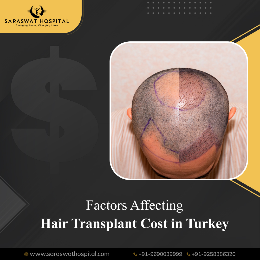 What is the Cost of Hair Transplant in Turkey? - Saraswat Hospital