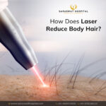 How is Laser Hair Removal Done