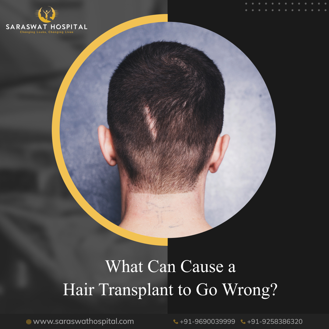 What Can Cause a Hair Transplant to Go Wrong