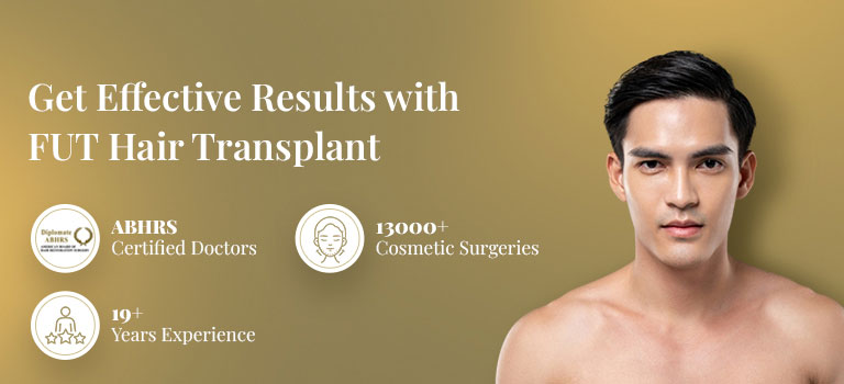 FUT Hair Transplant in India | Follicular Unit Transplantation