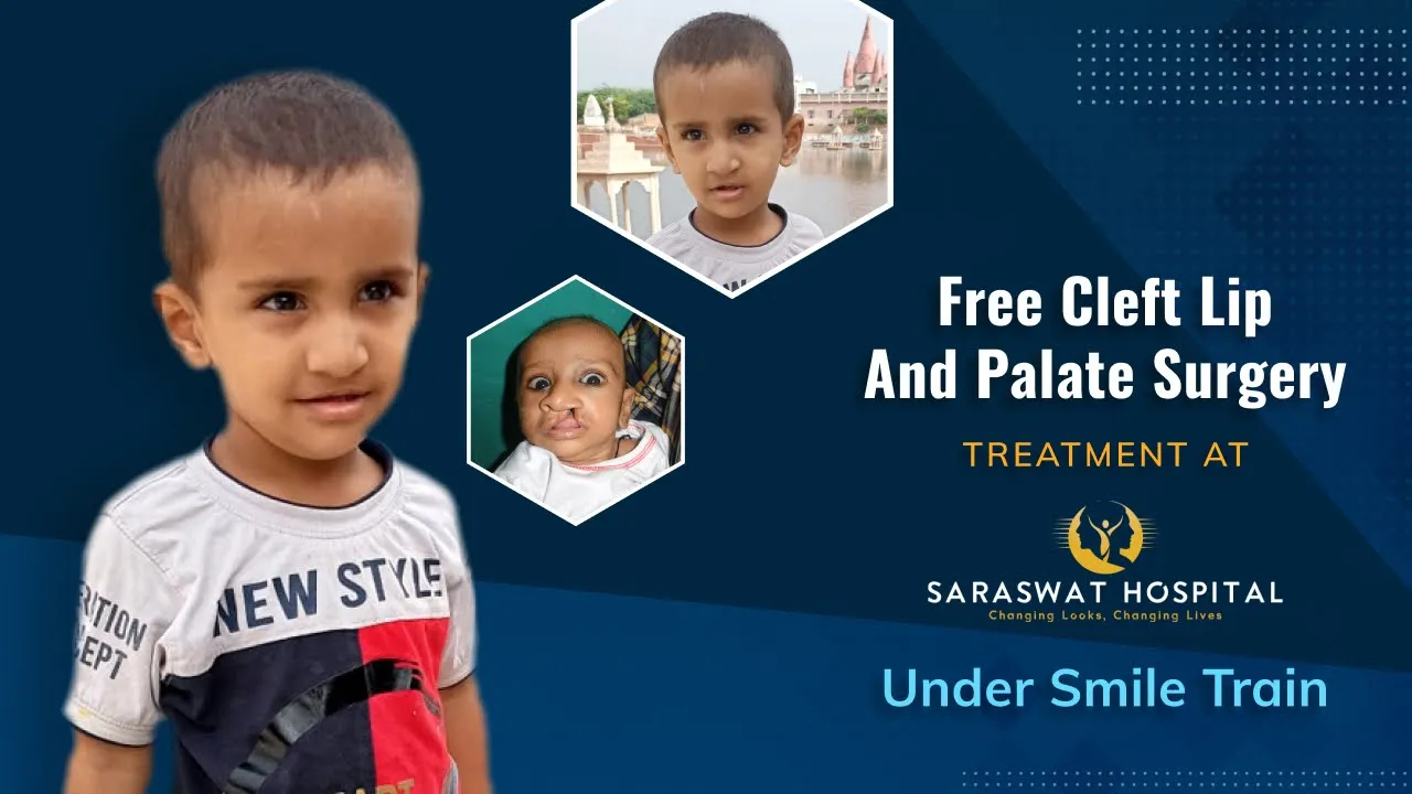 free cleft surgery at saraswat hospital under smile train