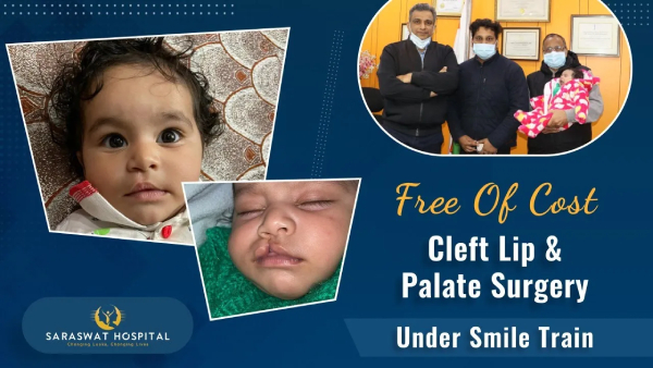 free cleft surgery in Agra