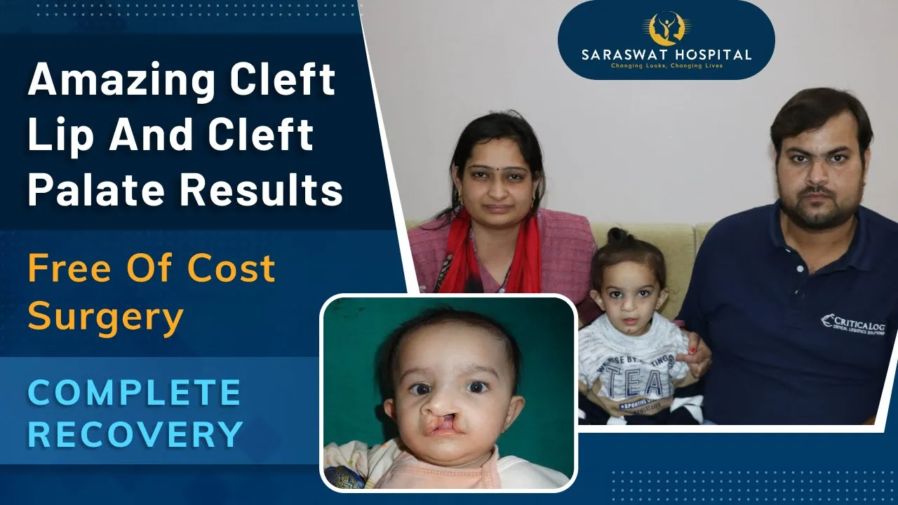 free cleft surgery